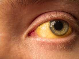 Hepatitis Care