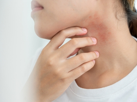 Skin Infection